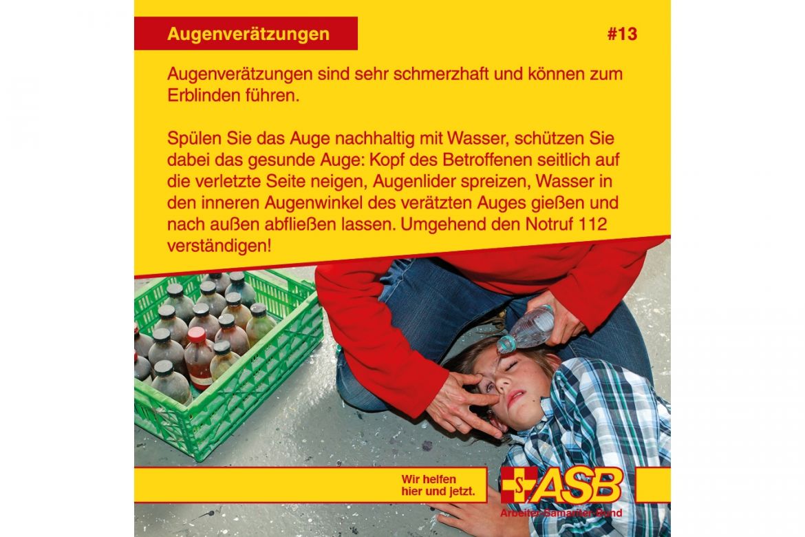 Erste Hilfe bei Augenverätzungen