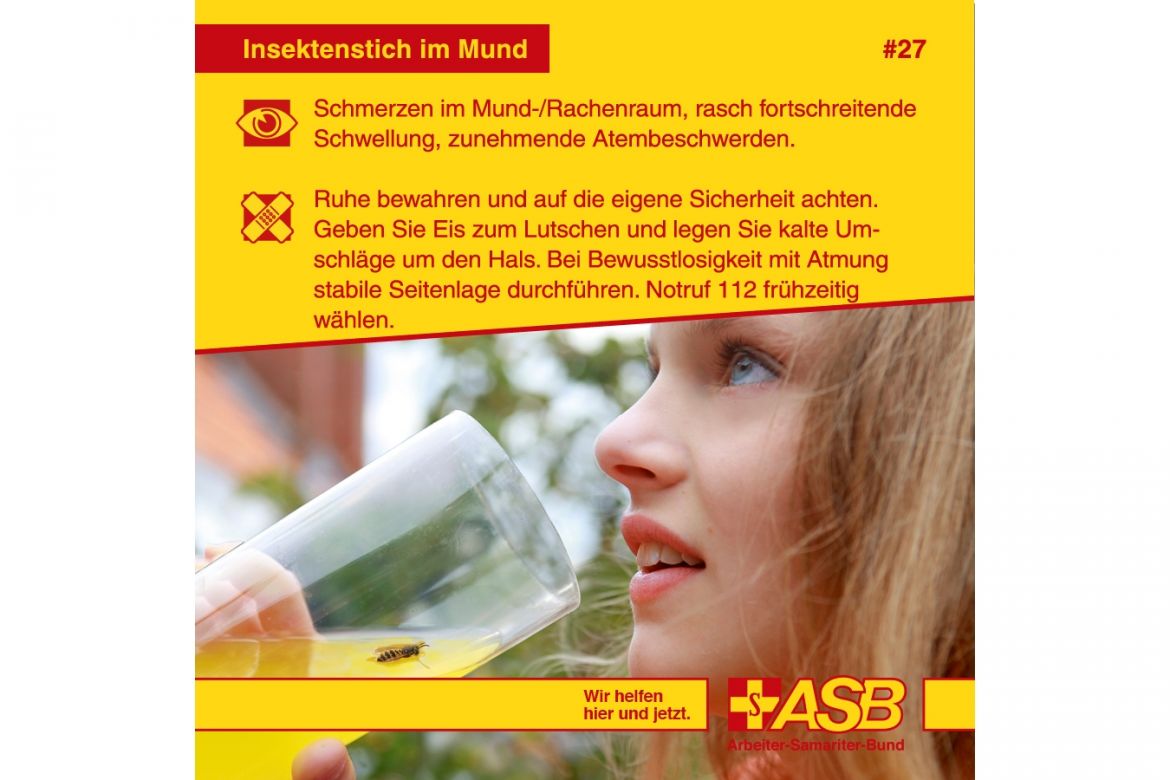 Erste-Hilfe-Tipp 27: Insektenstich im Mund-/Rachenraum