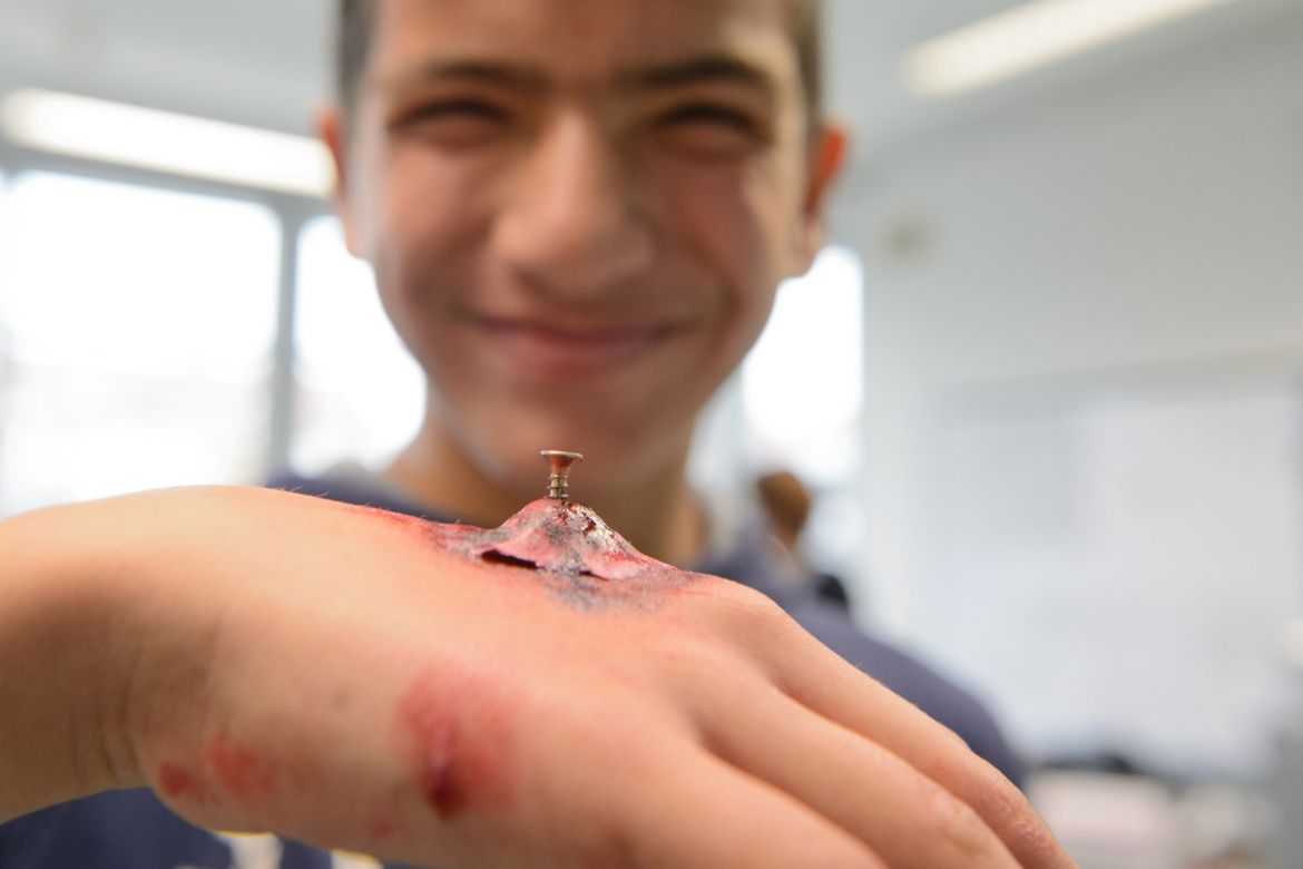 Eine ganze Schule lernt Erste Hilfe: Nagel in der Hand